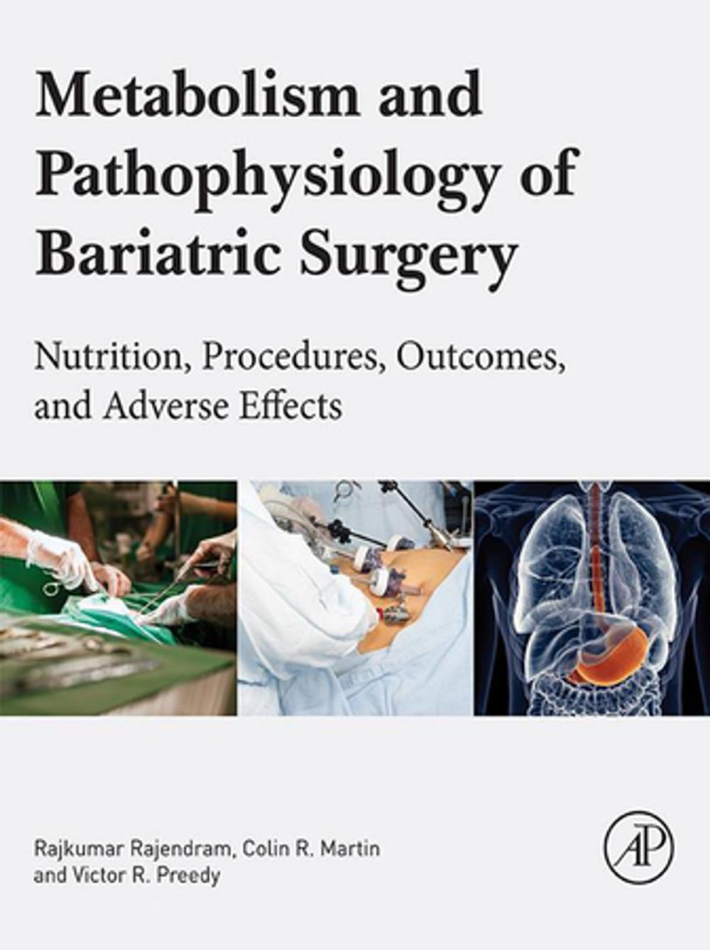 Big bigCover of Metabolism and Pathophysiology of Bariatric Surgery