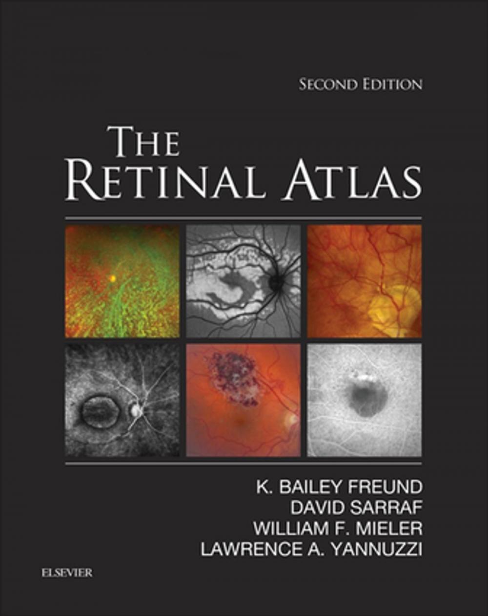 Big bigCover of The Retinal Atlas E-Book