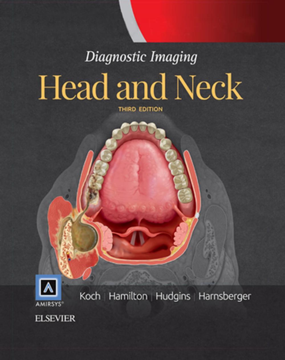 Big bigCover of Diagnostic Imaging: Head and Neck E-Book