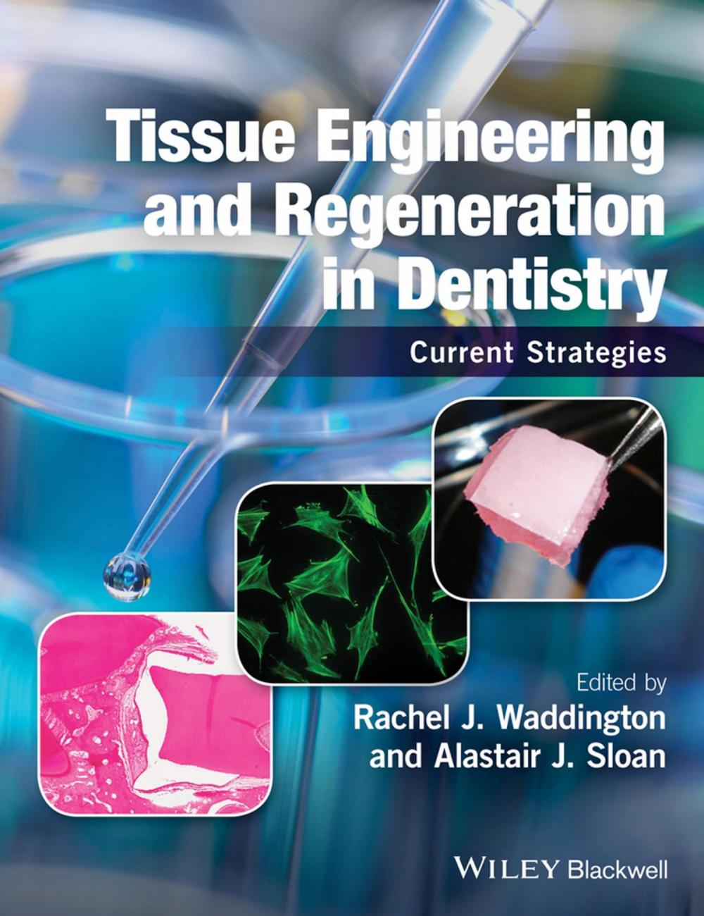 Big bigCover of Tissue Engineering and Regeneration in Dentistry