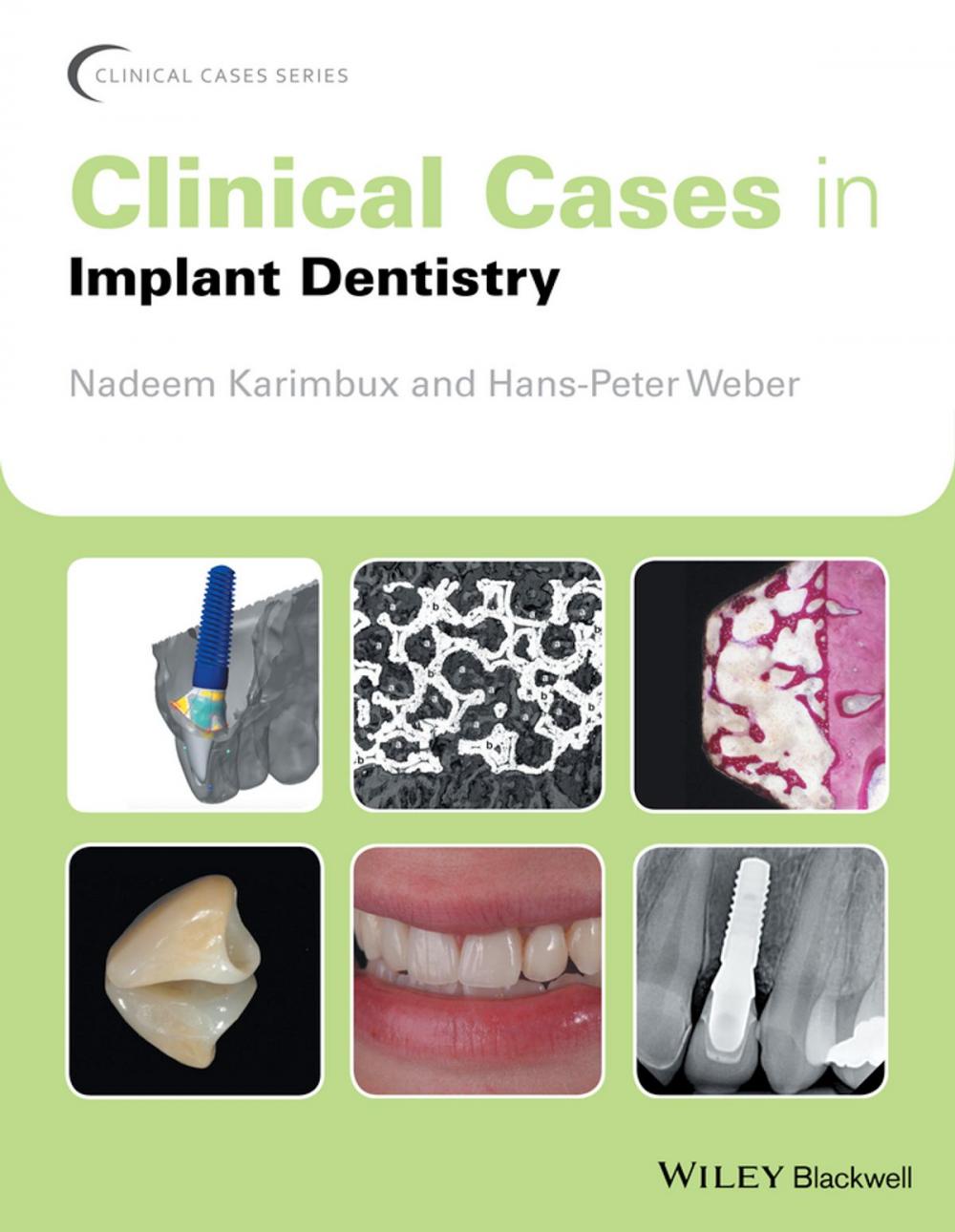 Big bigCover of Clinical Cases in Implant Dentistry