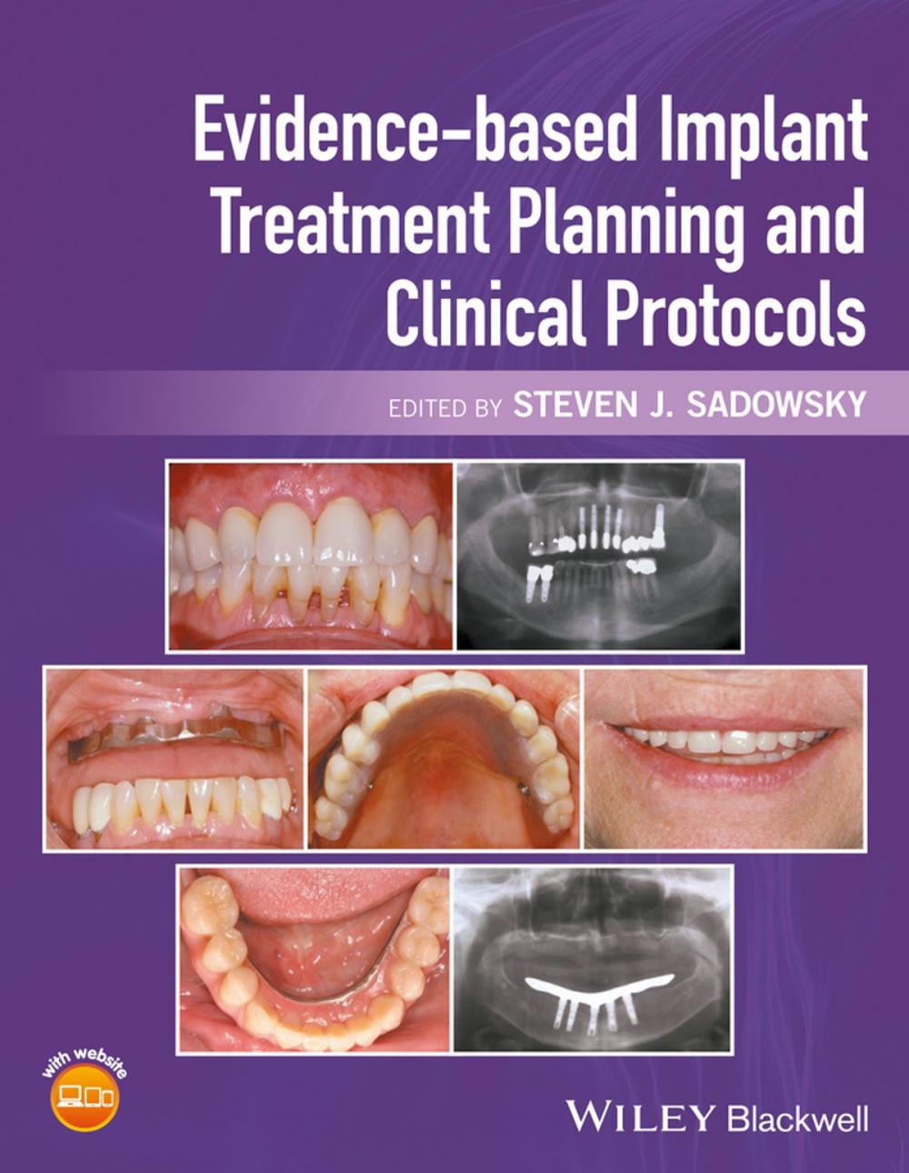 Big bigCover of Evidence-based Implant Treatment Planning and Clinical Protocols