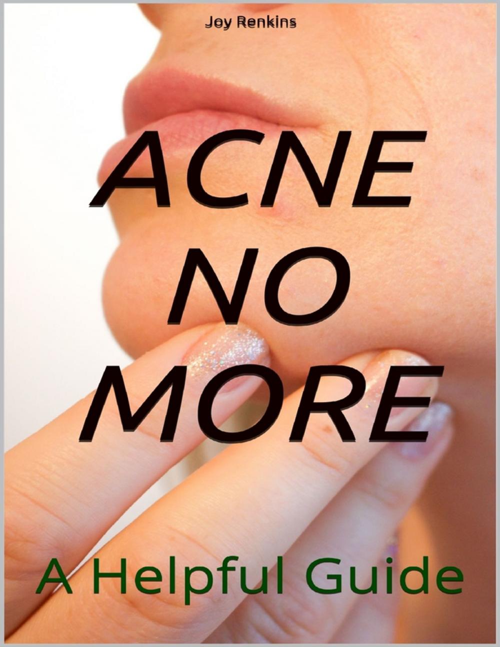 Big bigCover of Acne No More;A Helpful Guide