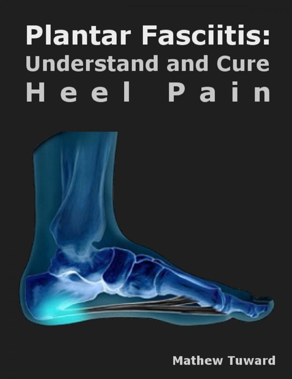 Big bigCover of Plantar Fasciitis: Understand and Cure Heel Pain