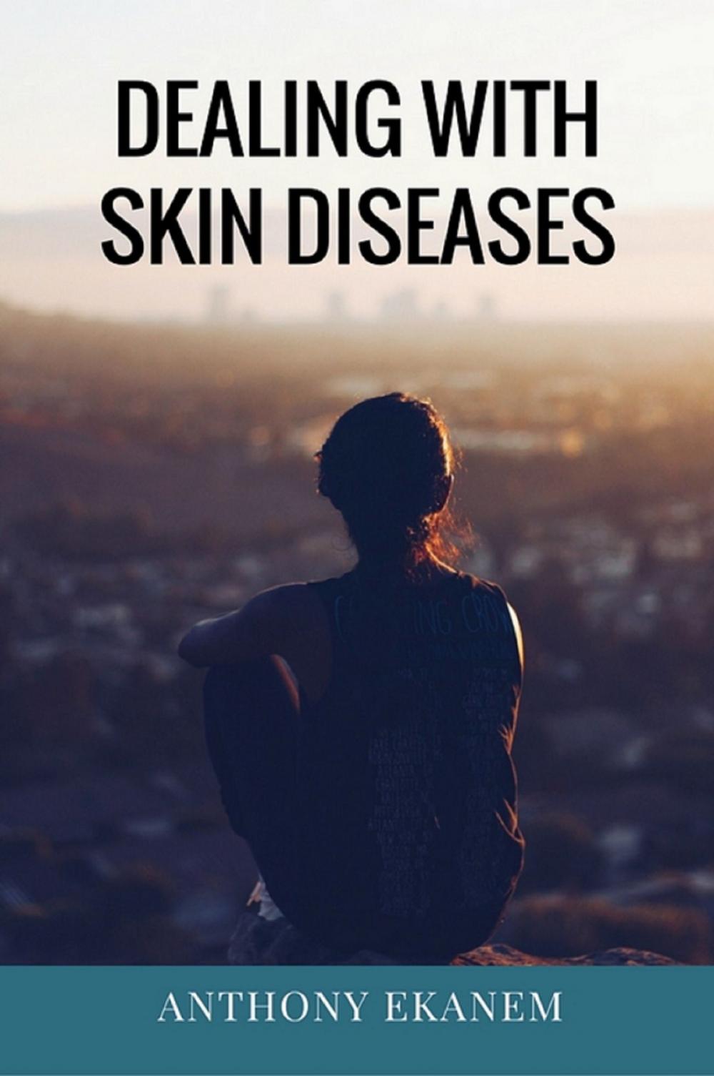 Big bigCover of Dealing with Skin Diseases