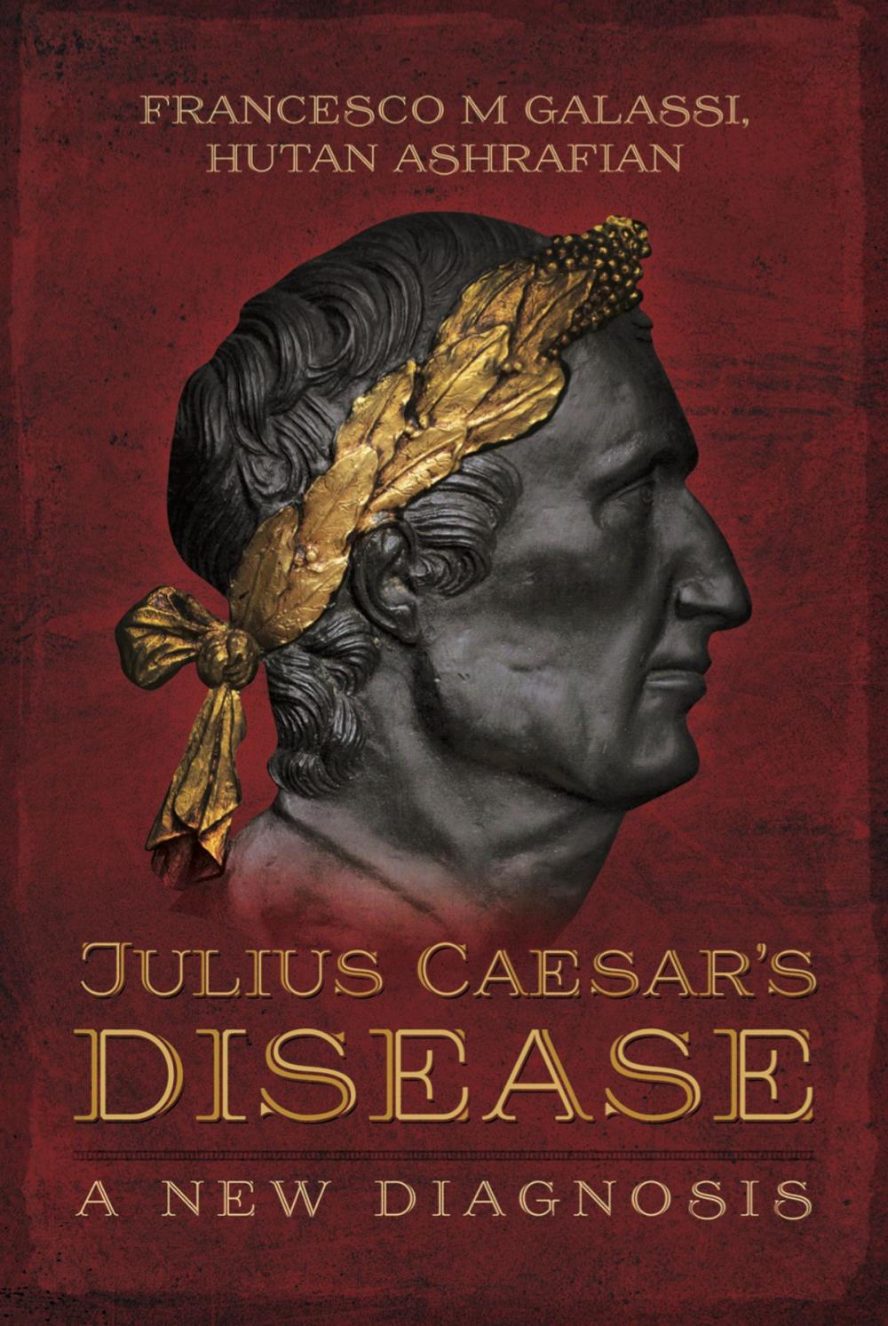 Big bigCover of Julius Caesar's Disease