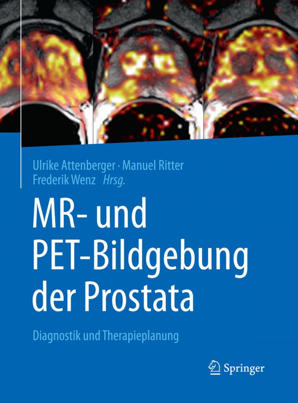 Big bigCover of MR- und PET-Bildgebung der Prostata