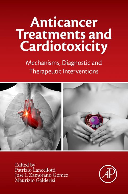 Cover of the book Anticancer Treatments and Cardiotoxicity by , Elsevier Science