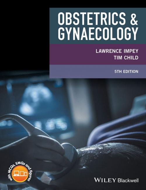 Cover of the book Obstetrics and Gynaecology by Lawrence Impey, Tim Child, Wiley