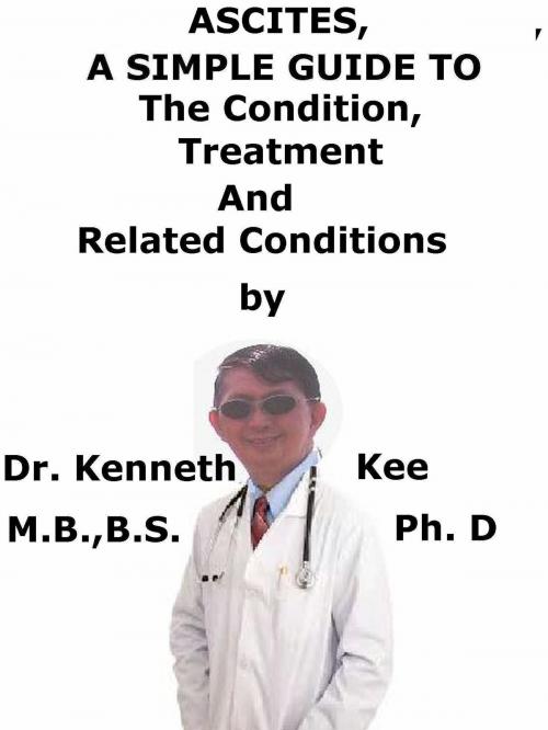 Cover of the book Ascites, A Simple Guide To The Condition, Treatment And Related Conditions by Kenneth Kee, Kenneth Kee