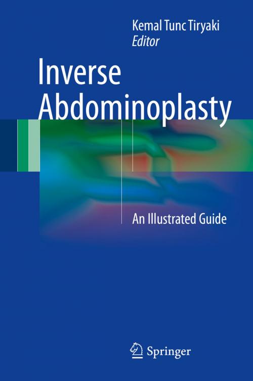 Cover of the book Inverse Abdominoplasty by , Springer International Publishing