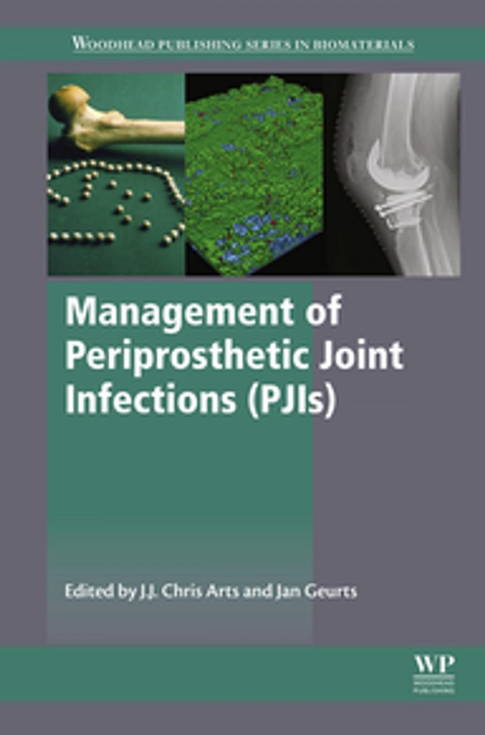 Big bigCover of Management of Periprosthetic Joint Infections (PJIs)