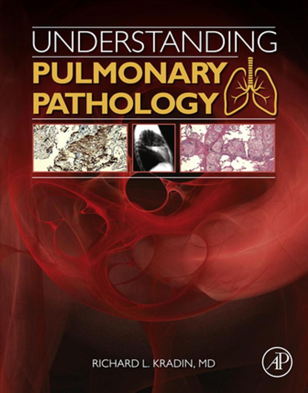 Big bigCover of Understanding Pulmonary Pathology