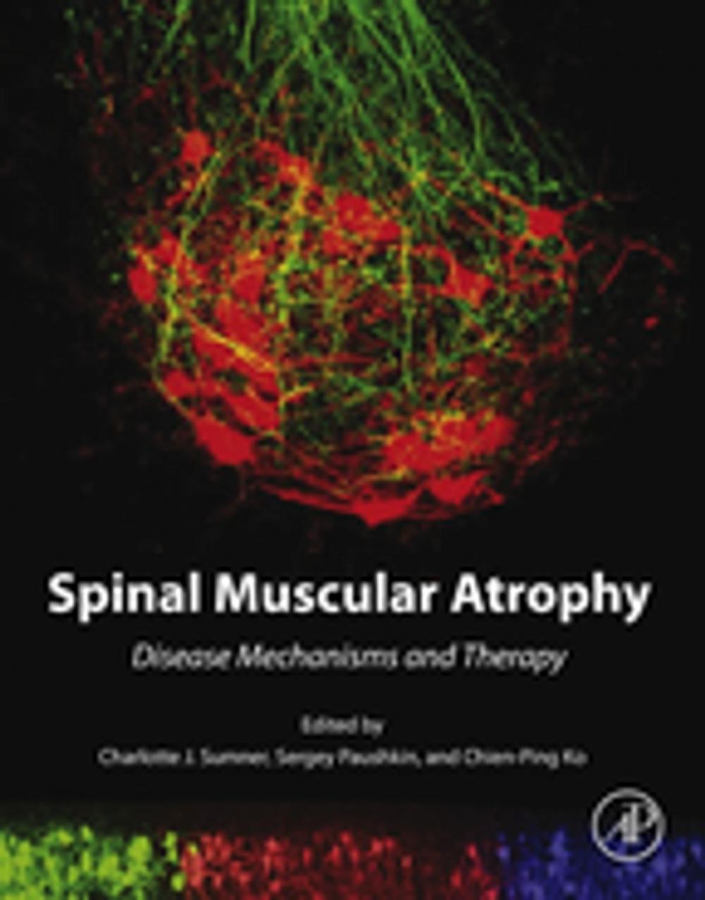 Big bigCover of Spinal Muscular Atrophy