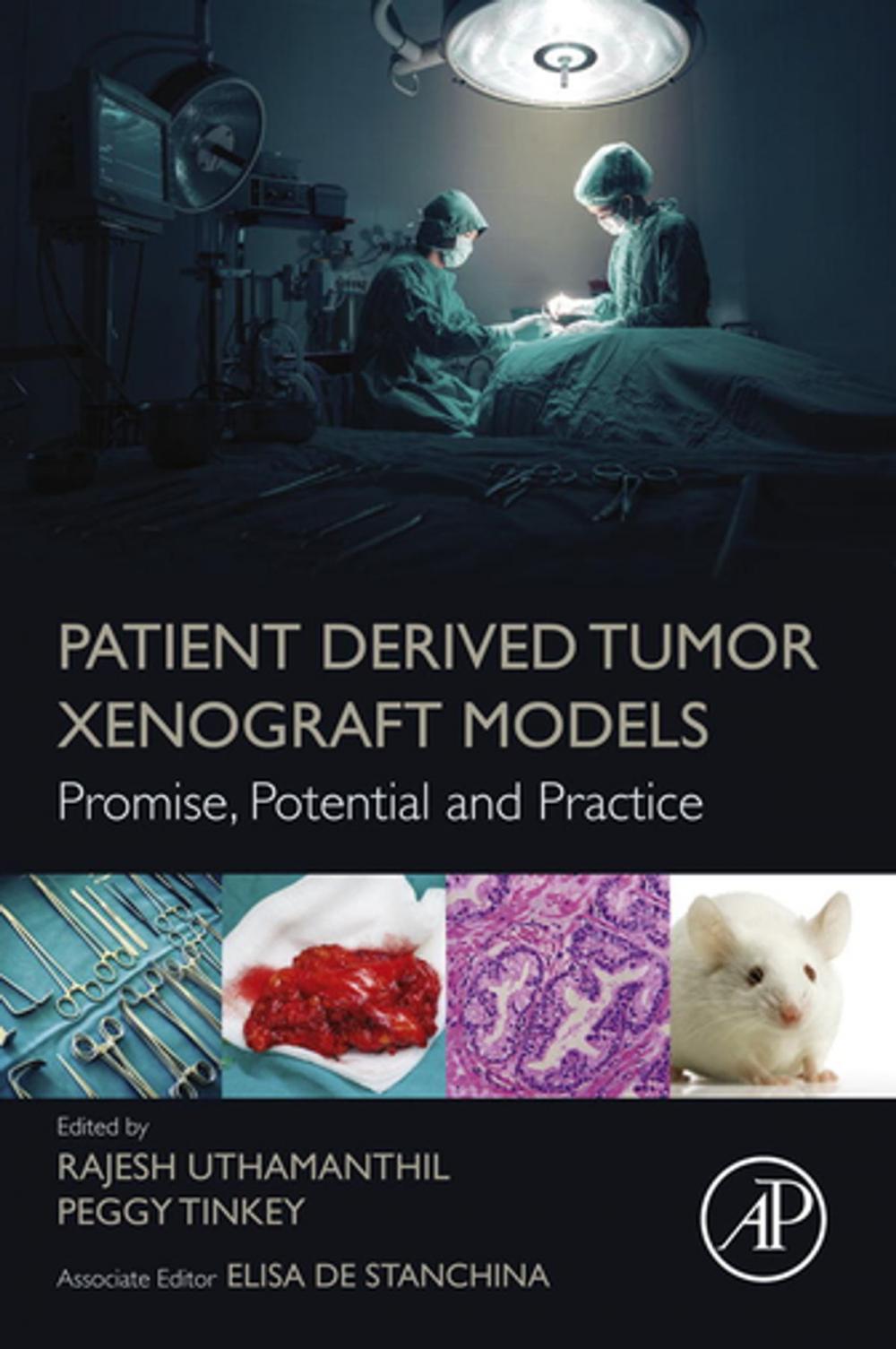 Big bigCover of Patient Derived Tumor Xenograft Models