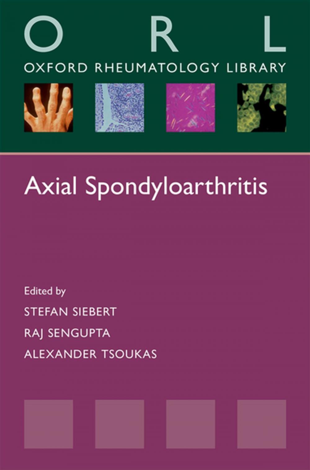 Big bigCover of Axial Spondyloarthritis