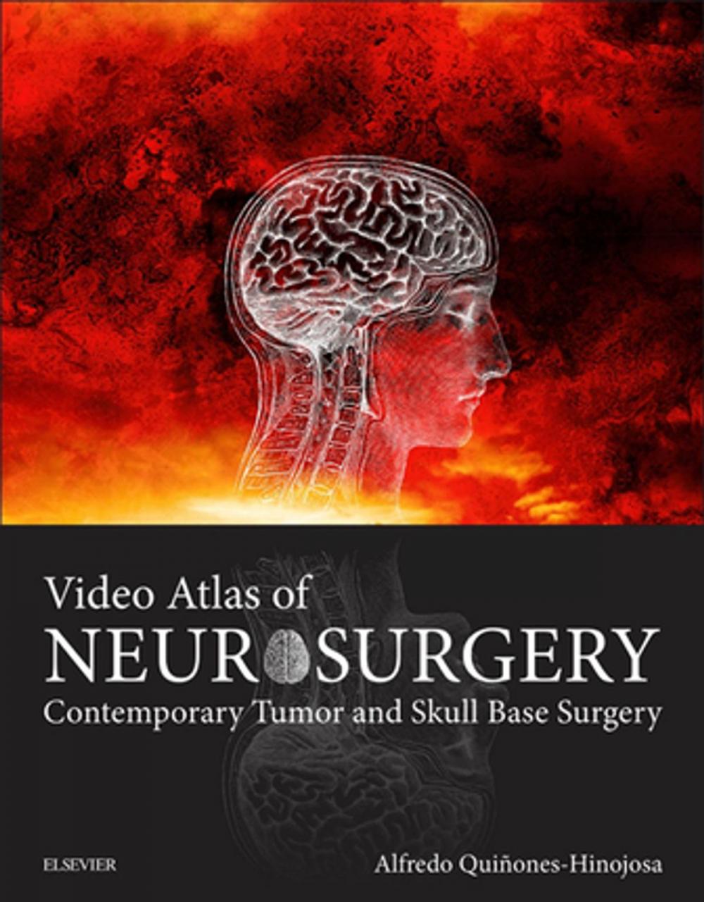 Big bigCover of Video Atlas of Neurosurgery E-Book