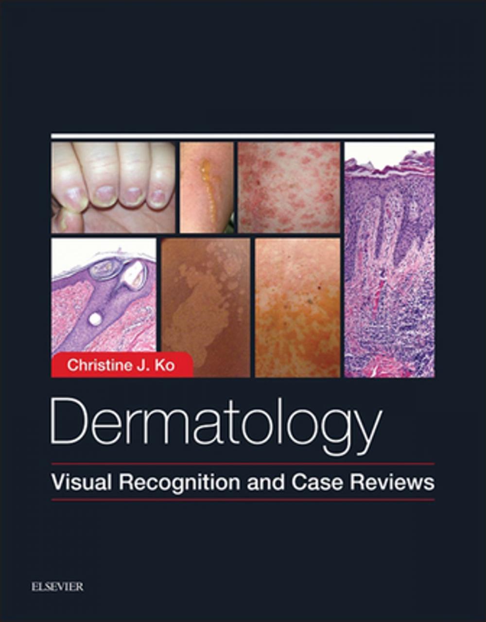 Big bigCover of Dermatology: Visual Recognition and Case Reviews E-Book