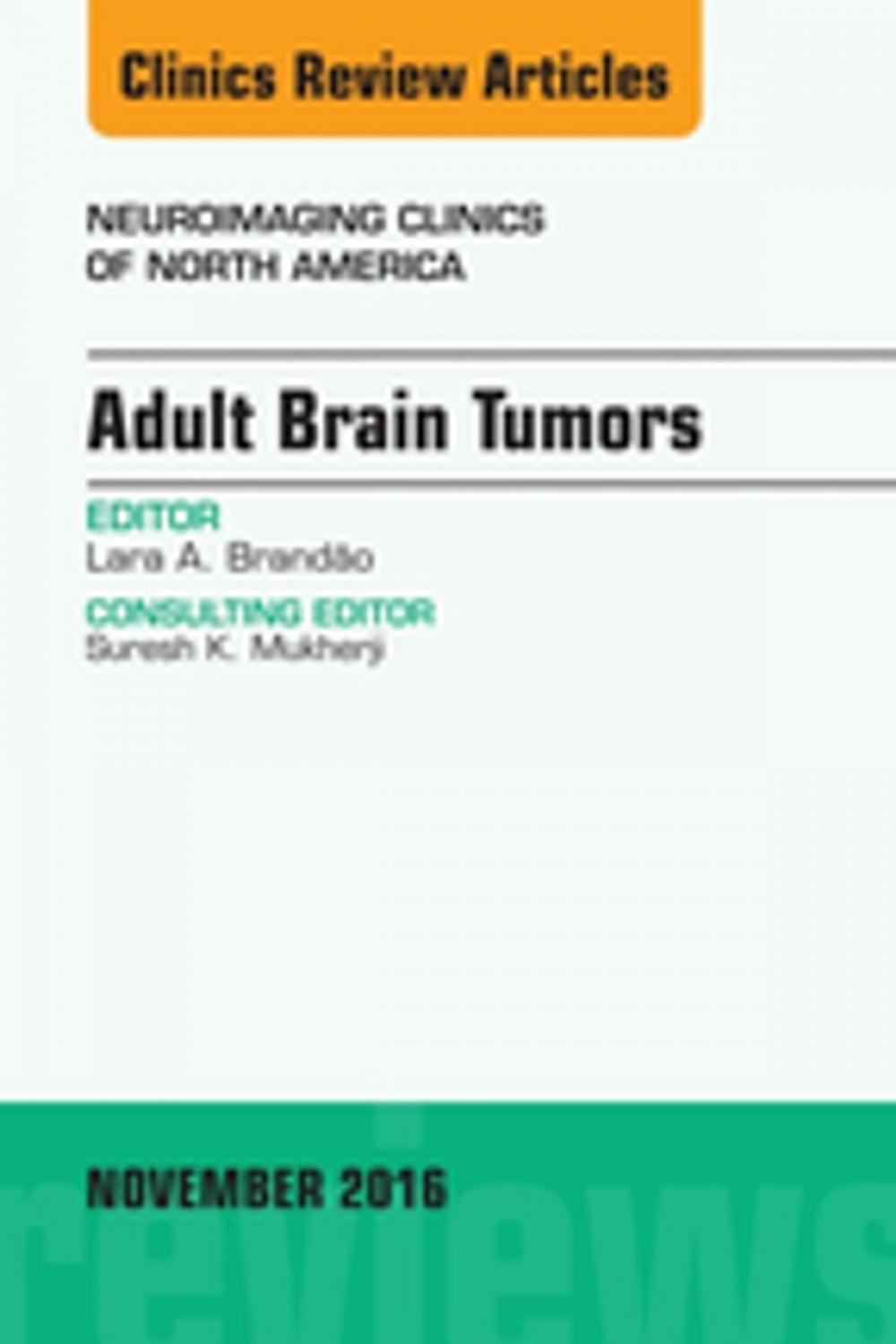 Big bigCover of Adult Brain Tumors, An Issue of Neuroimaging Clinics of North America, E-Book