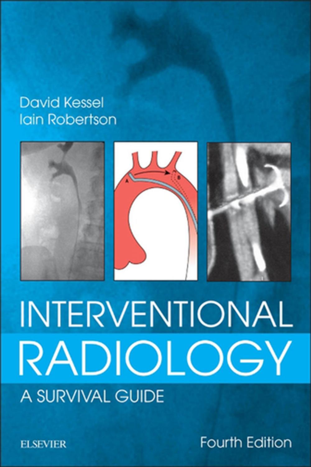 Big bigCover of Interventional Radiology: A Survival Guide E-Book