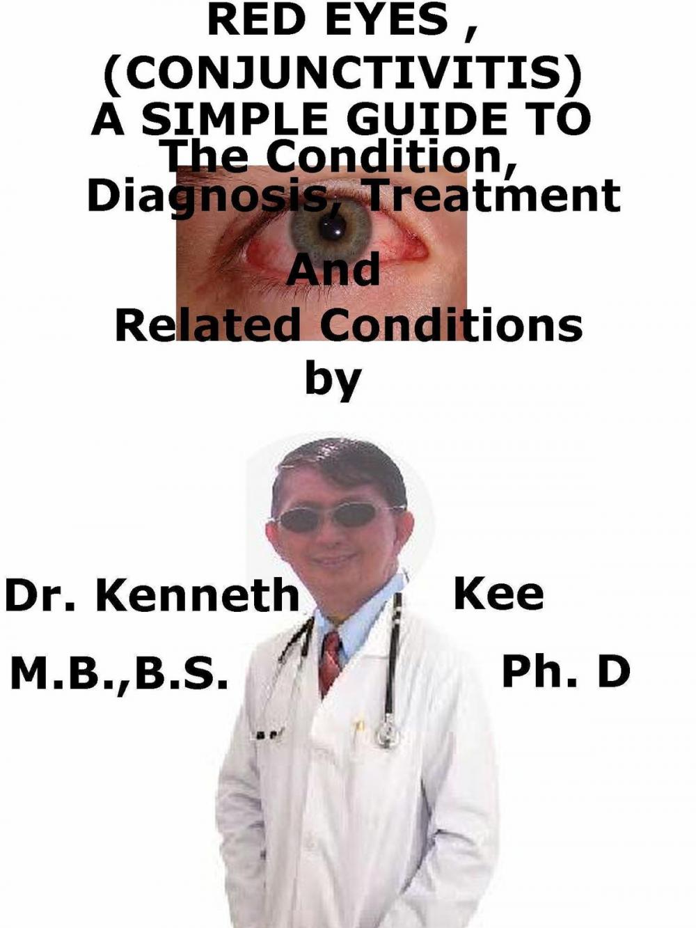 Big bigCover of Red Eyes (Conjunctivitis), A Simple Guide To The Condition, Diagnosis, Treatment And Related Conditions