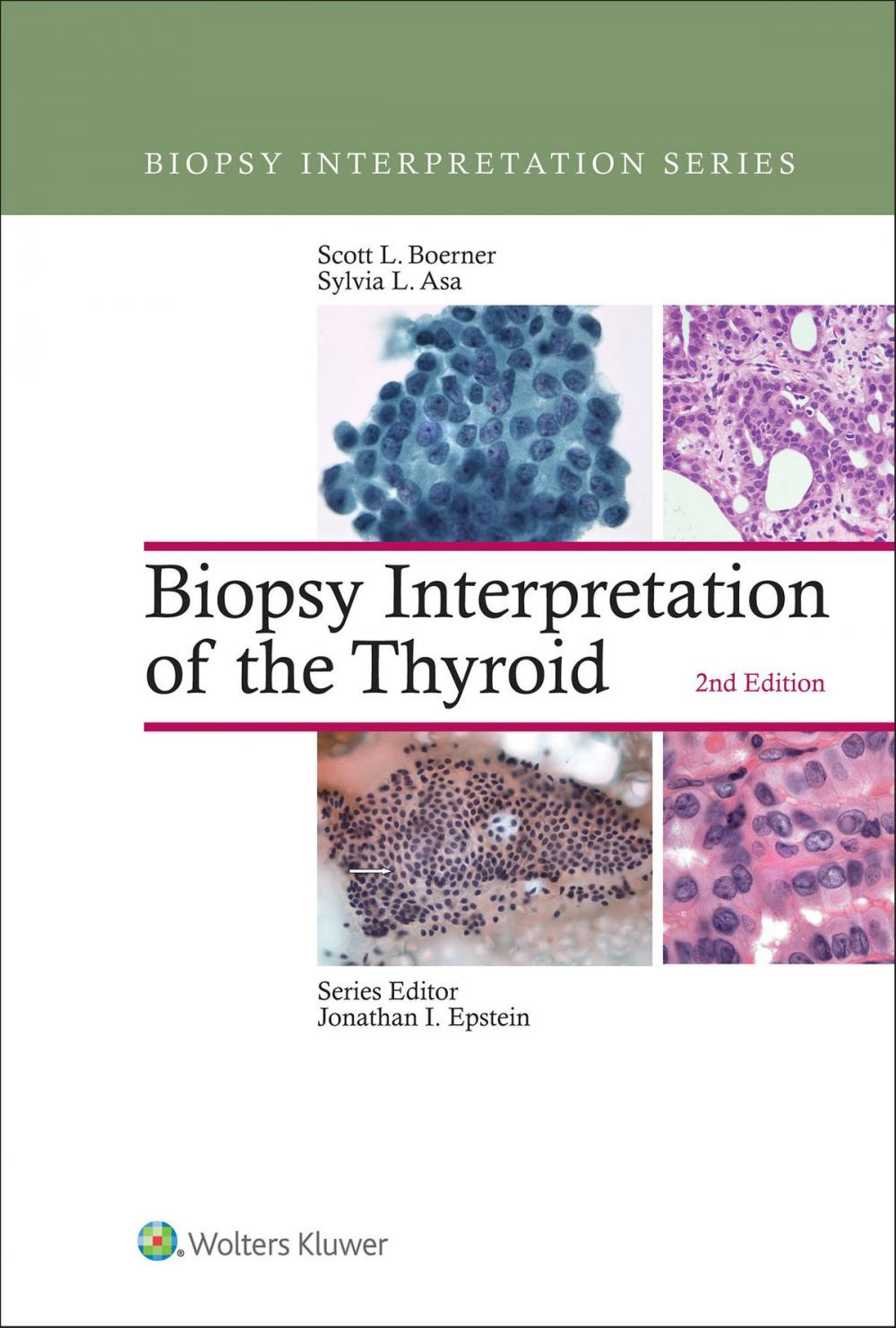 Big bigCover of Biopsy Interpretation of the Thyroid