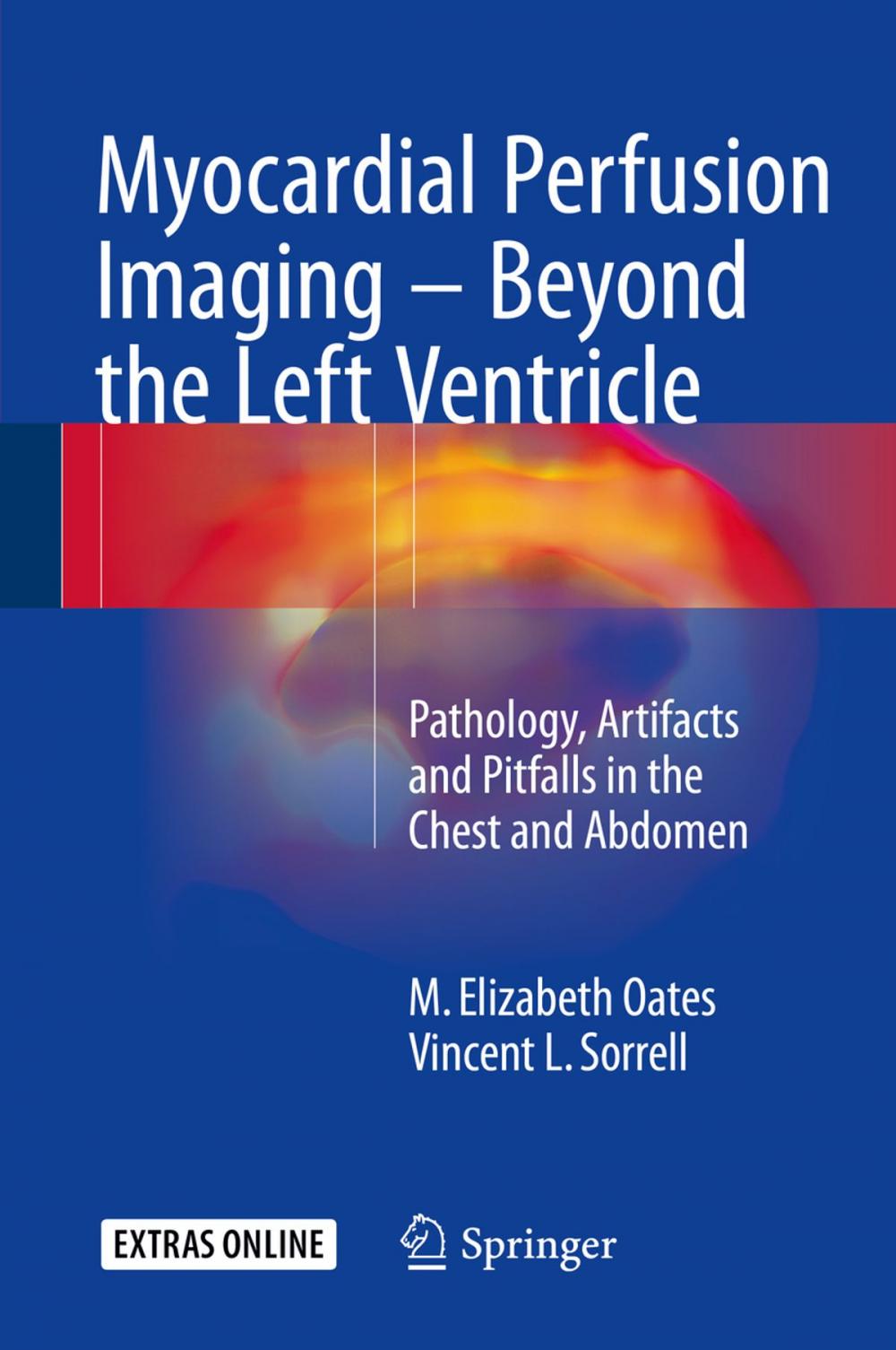 Big bigCover of Myocardial Perfusion Imaging - Beyond the Left Ventricle