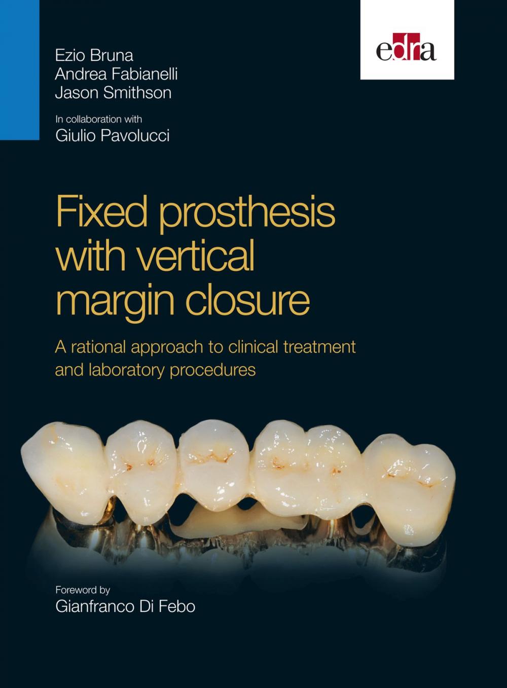 Big bigCover of Fixed prosthesis with vertical margin closure