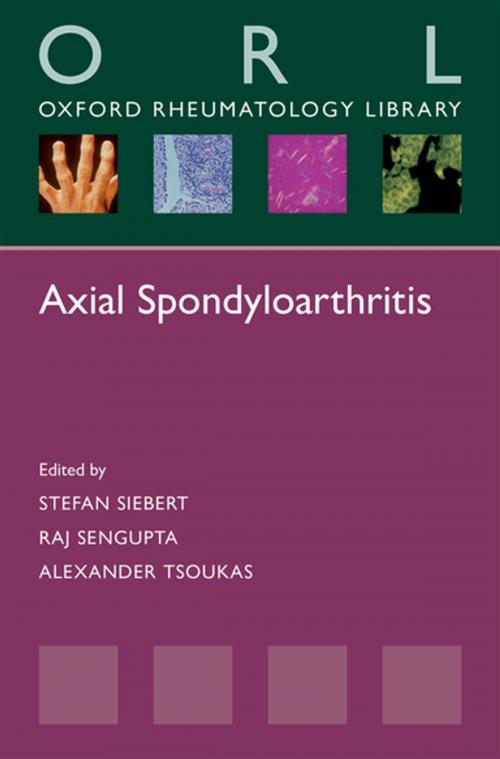 Cover of the book Axial Spondyloarthritis by , OUP Oxford