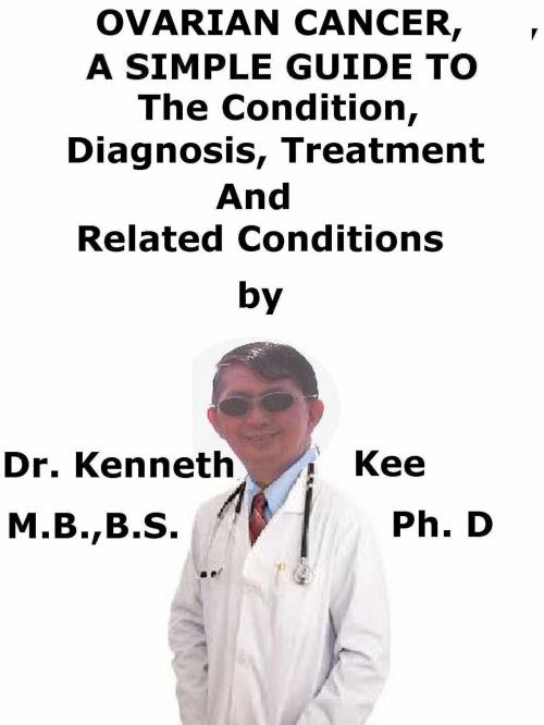 Cover of the book Ovarian Cancer, A Simple Guide To The Condition, Diagnosis, Treatment by Kenneth Kee, Kenneth Kee