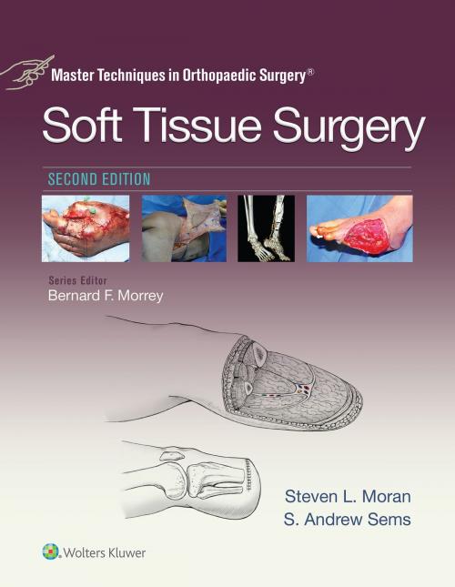 Cover of the book Master Techniques in Orthopaedic Surgery: Soft Tissue Surgery by Steven Moran, Wolters Kluwer Health