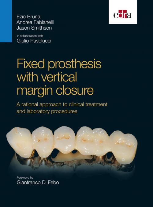 Cover of the book Fixed prosthesis with vertical margin closure by Ezio Bruna, Andrea Fabianelli, Edra