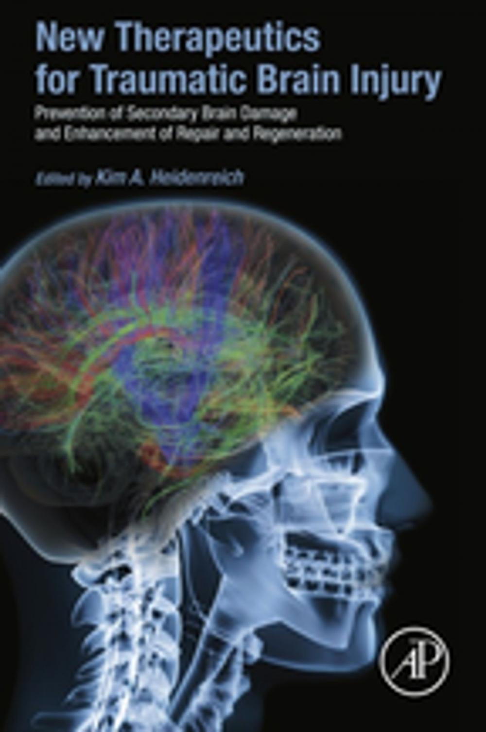 Big bigCover of New Therapeutics for Traumatic Brain Injury