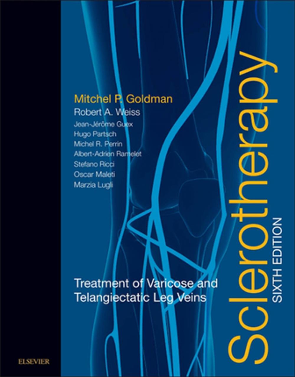 Big bigCover of Sclerotherapy E-Book