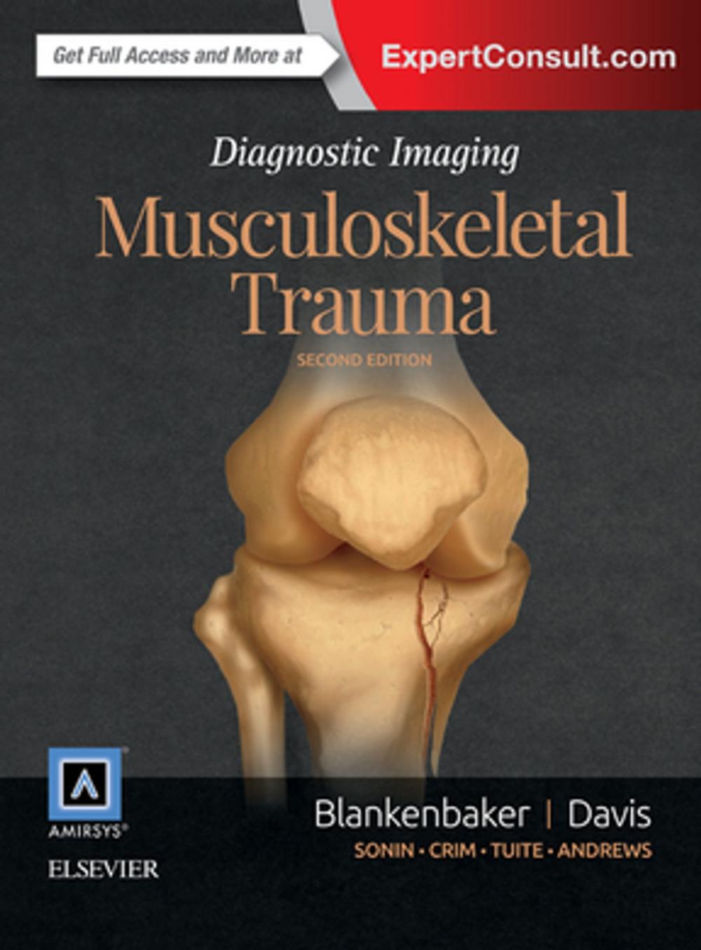 Big bigCover of Diagnostic Imaging: Musculoskeletal Trauma E-Book