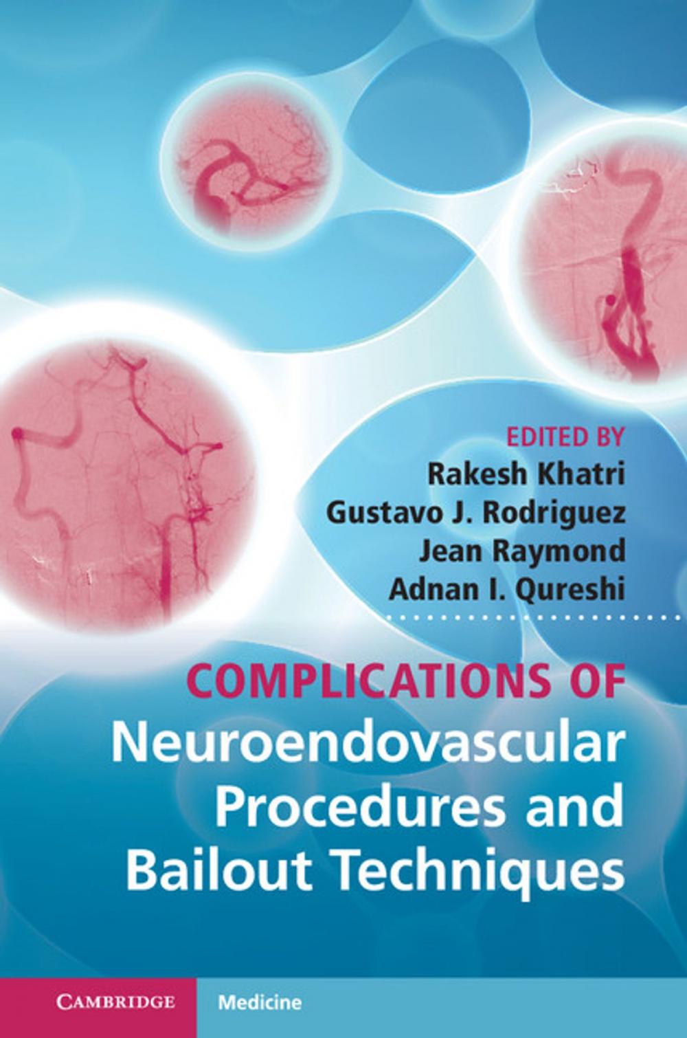 Big bigCover of Complications of Neuroendovascular Procedures and Bailout Techniques