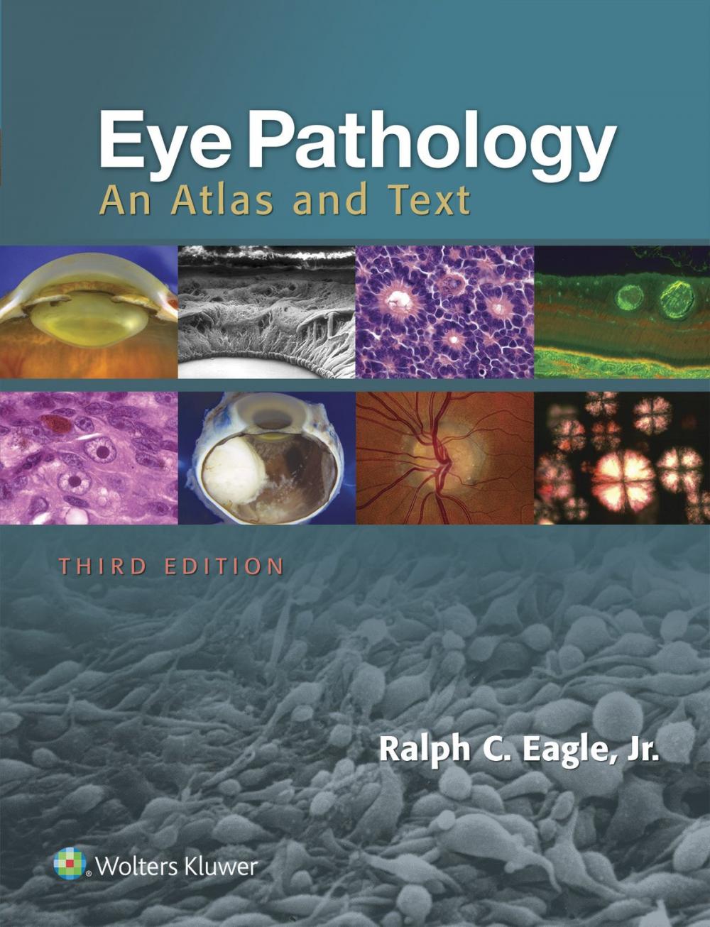 Big bigCover of Eye Pathology