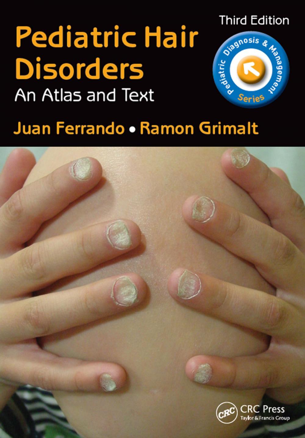 Big bigCover of Pediatric Hair Disorders