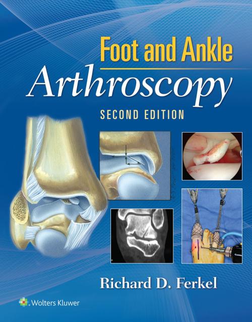 Cover of the book Foot & Ankle Arthroscopy by Richard D. Ferkel, Wolters Kluwer Health