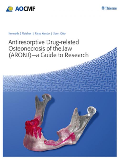 Cover of the book Antiresorptive Drug-Related Osteonecrosis of the Jaw (ARONJ) - A Guide to Research by , Thieme