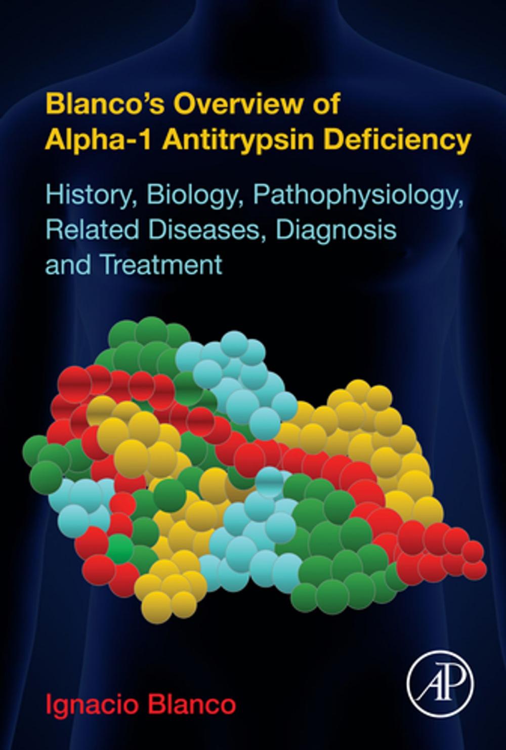 Big bigCover of Blanco's Overview of Alpha-1 Antitrypsin Deficiency