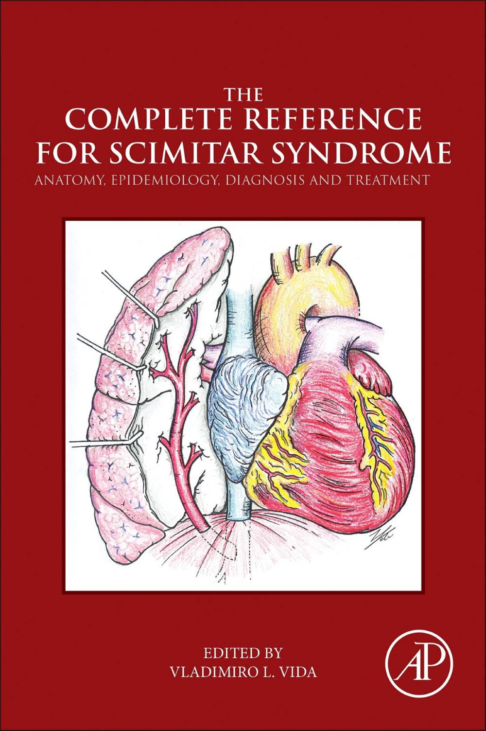 Big bigCover of The Complete Reference for Scimitar Syndrome