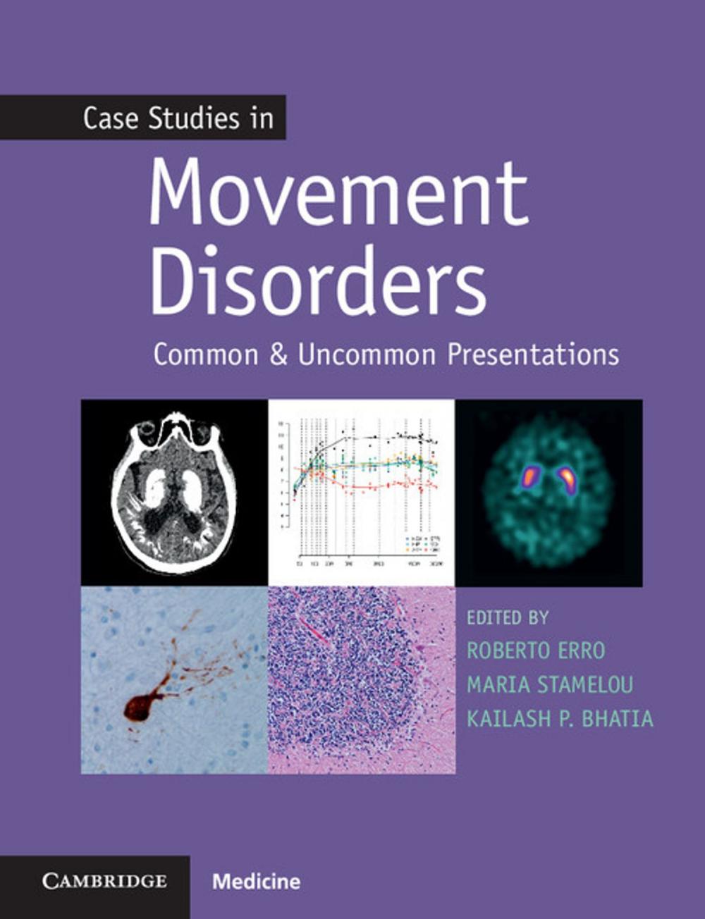 Big bigCover of Case Studies in Movement Disorders