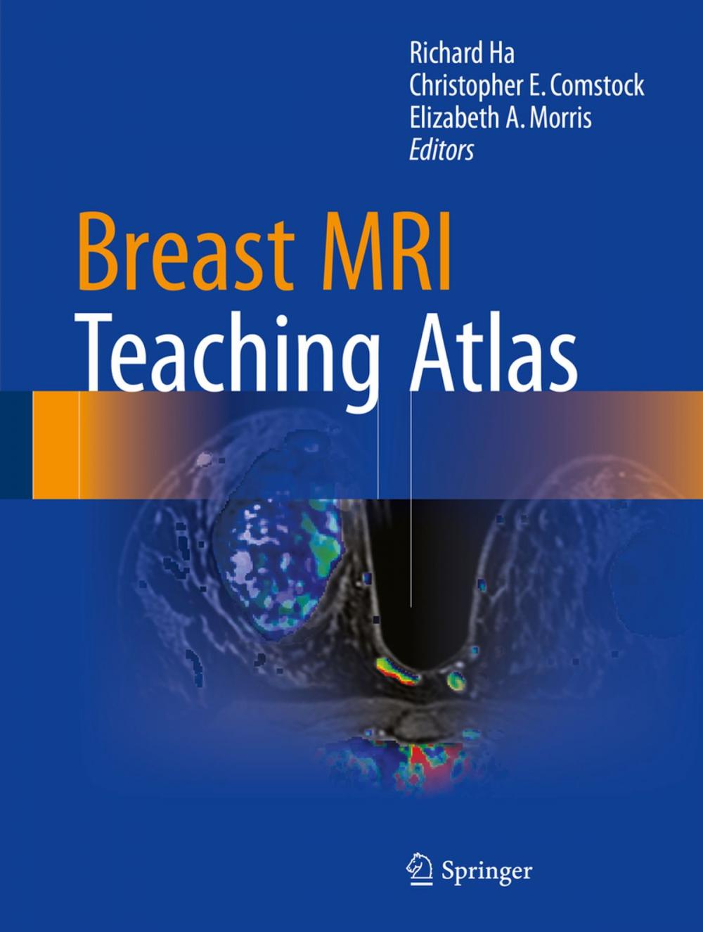 Big bigCover of Breast MRI Teaching Atlas