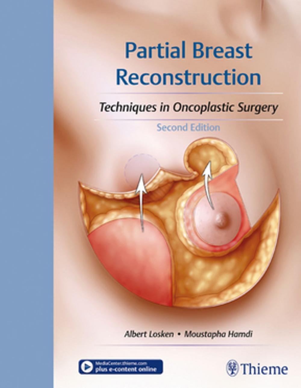 Big bigCover of Partial Breast Reconstruction