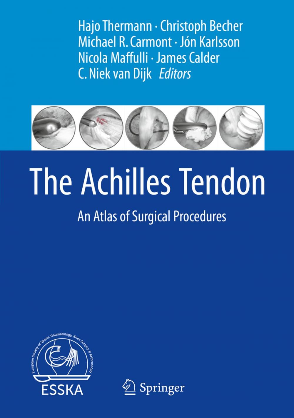 Big bigCover of The Achilles Tendon