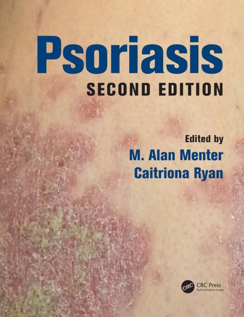 Cover of the book Psoriasis by , CRC Press