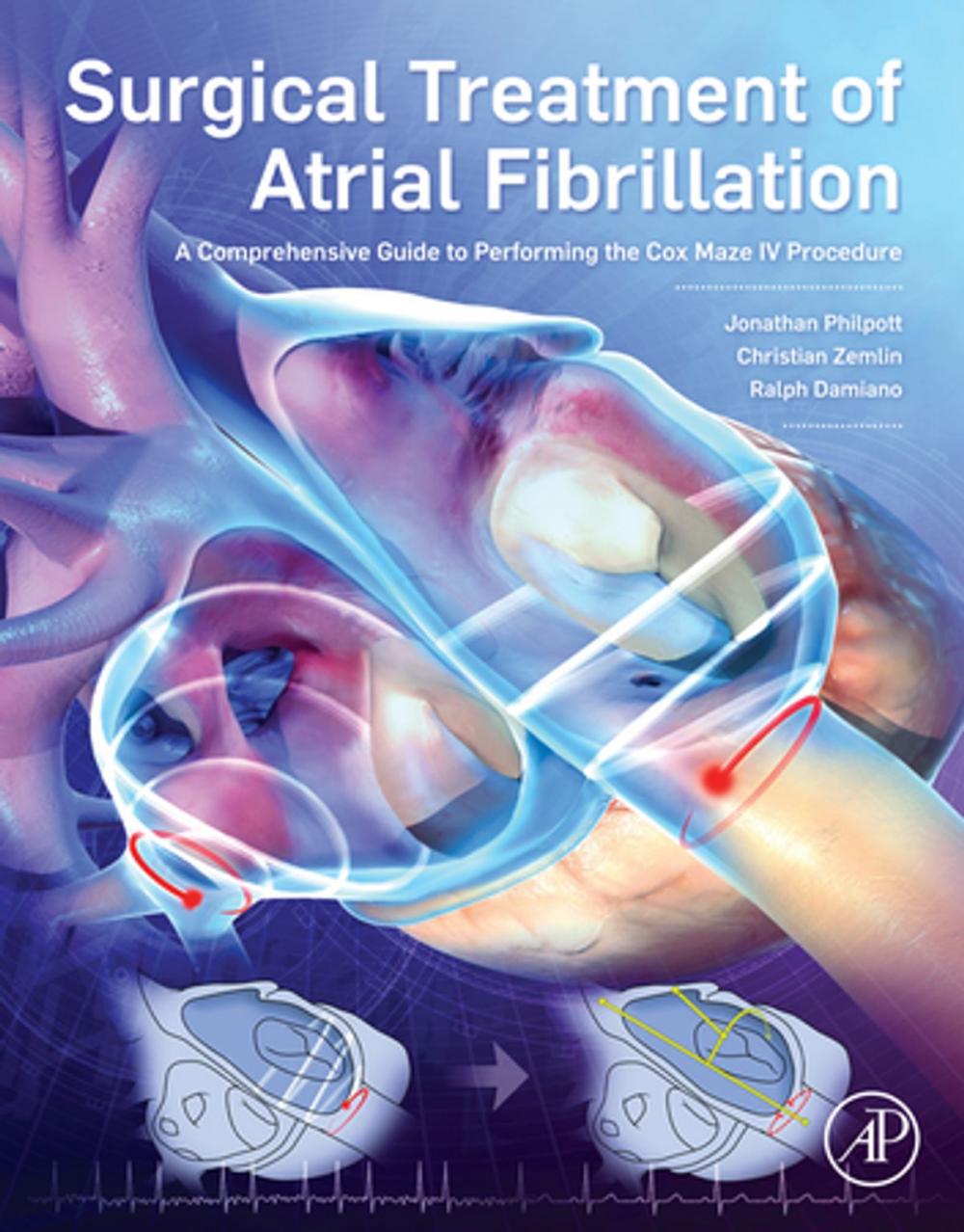 Big bigCover of Surgical Treatment of Atrial Fibrillation