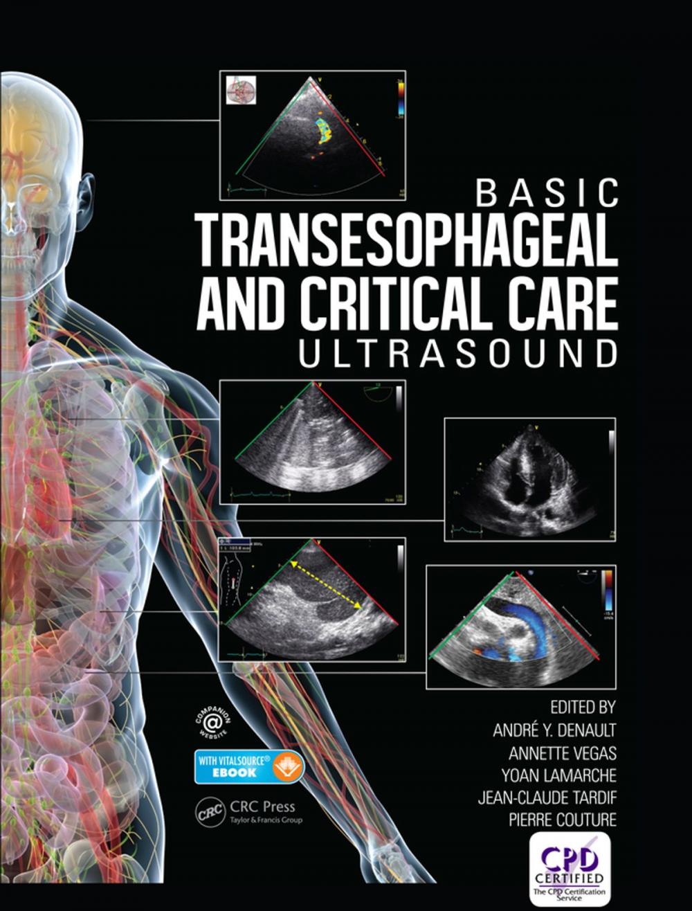 Big bigCover of Basic Transesophageal and Critical Care Ultrasound