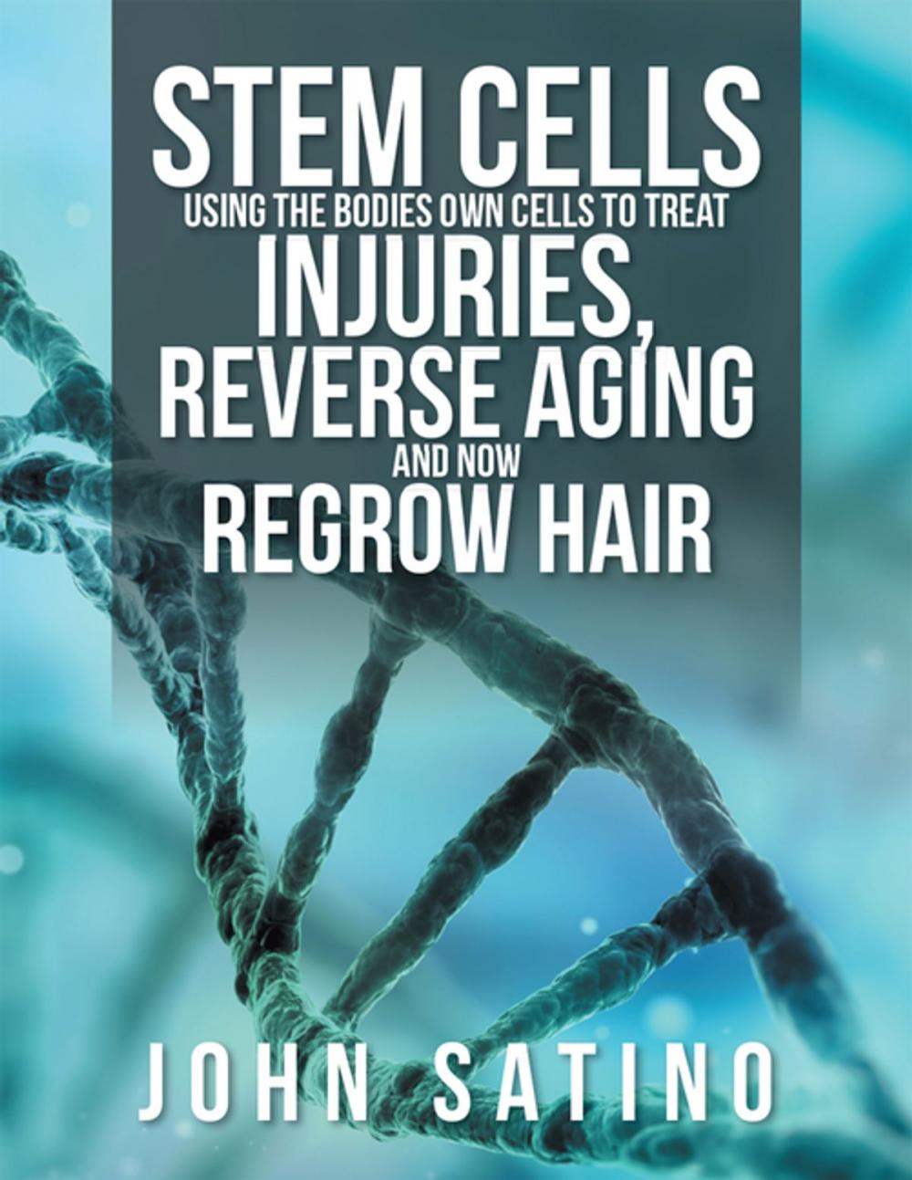 Big bigCover of Stem Cells Using the Bodies Own Cells to Treat Injuries, Reverse Aging and Now Regrow Hair